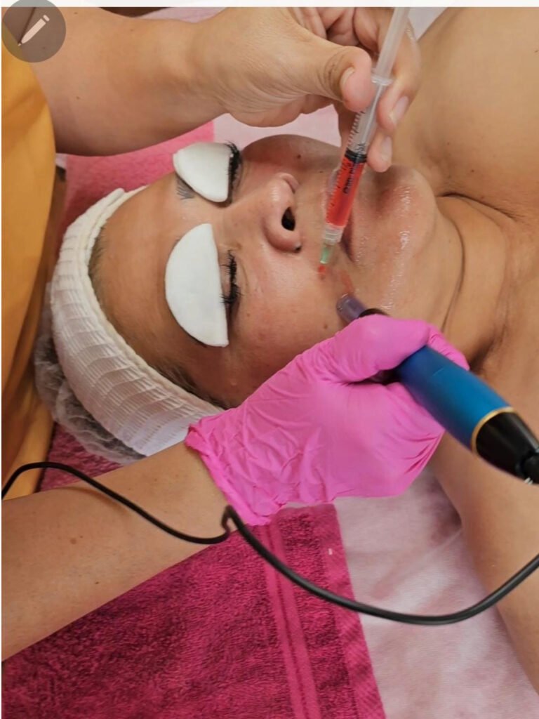 dermapen 1
