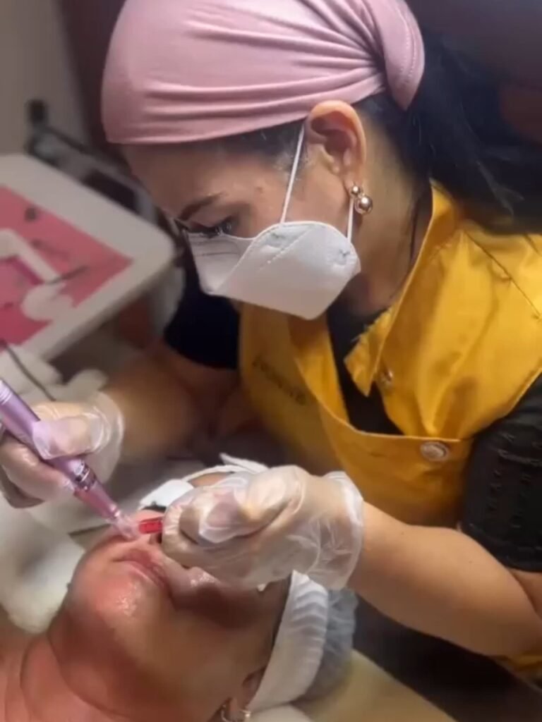 Dermapen