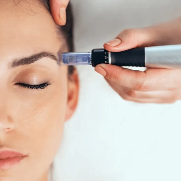 dermapen1