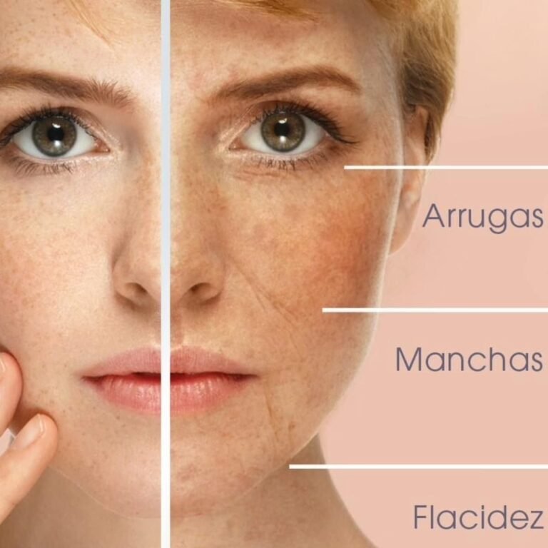 dermapen4